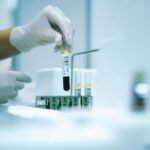 NIFTY teszt: a legpontosabb Down-szindróma szűrés terhesség alatt