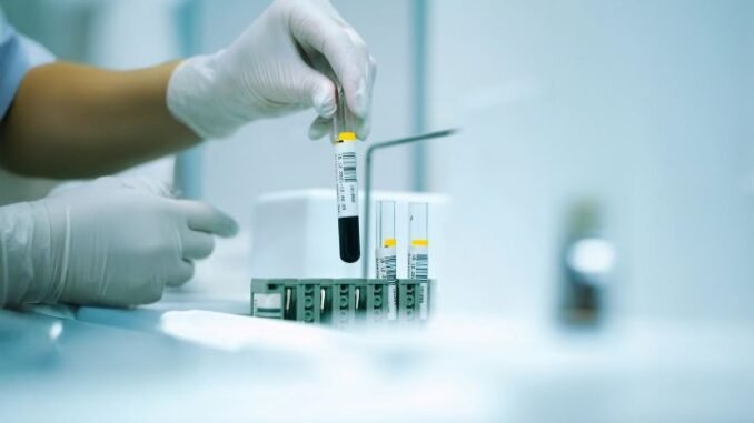 általános laborvizsgálat